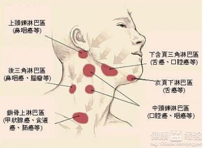 淋巴结肿大：茶叶饮用是否有益？如何安全饮用以促进复？