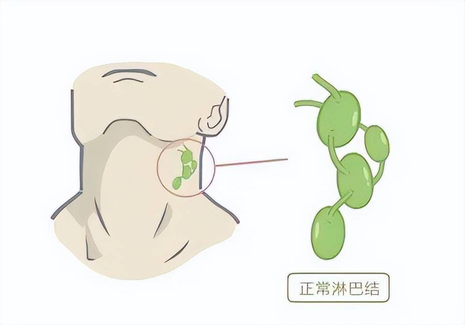 淋巴结肿大：茶叶饮用是否有益？如何安全饮用以促进复？