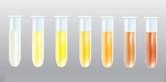尿液的颜色变化及其可能的原因：从红茶色到深黄色的解读
