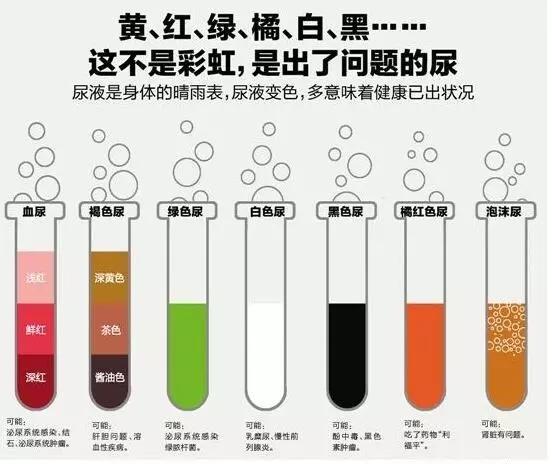 尿液的颜色变化及其可能的原因：从红茶色到深黄色的解读