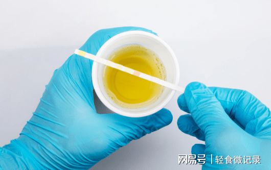 撒尿颜色像红茶水一样正常吗？这种现象的原因是什么？