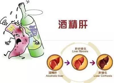 红茶过敏的全方位解决方案：症状、原因、预防和治疗方法