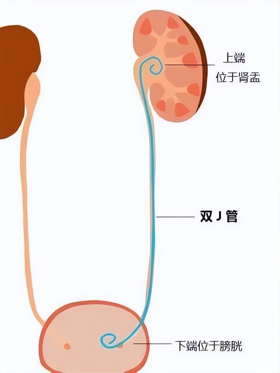 红茶水的适宜与禁忌人群：了解哪些人不适合喝红茶水以确保健饮水