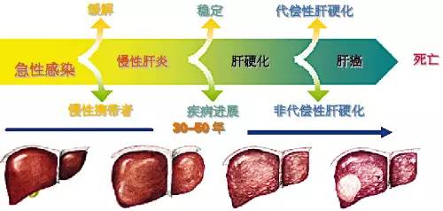 健肝脏护理：适合肝病患者的茶类选择指南