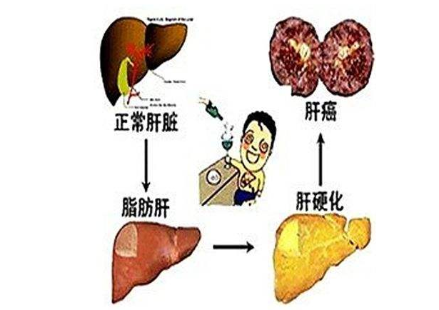 健肝脏护理：适合肝病患者的茶类选择指南