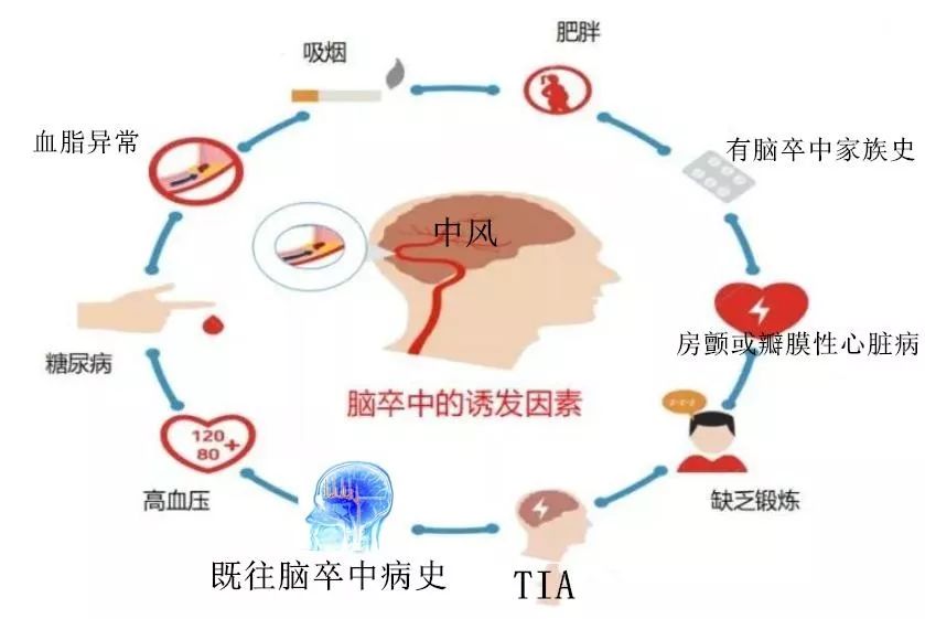 普洱茶引起胃灼热的多重因素解析及应对策略