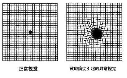 普洱茶纸黄斑问题详解与解决方案