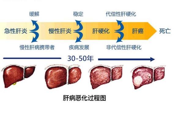 普洱茶对缓解鼻咽炎症状的影响与作用机制