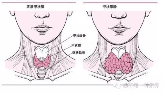 戴玉石容易长结节吗？