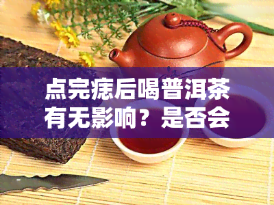 点完痣后喝普洱茶有无影响？是否会留下疤痕？