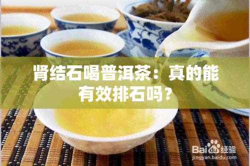 肾结石喝普洱茶：真的能有效排石吗？