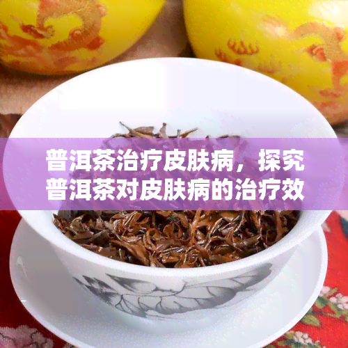 普洱茶治疗皮肤病，探究普洱茶对皮肤病的治疗效果