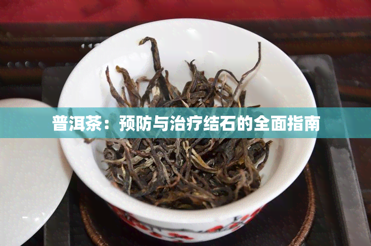 普洱茶：预防与治疗结石的全面指南