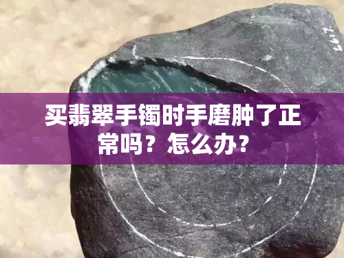 买翡翠手镯时手磨肿了正常吗？怎么办？