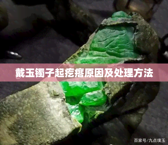 戴玉镯子起疙瘩原因及处理方法