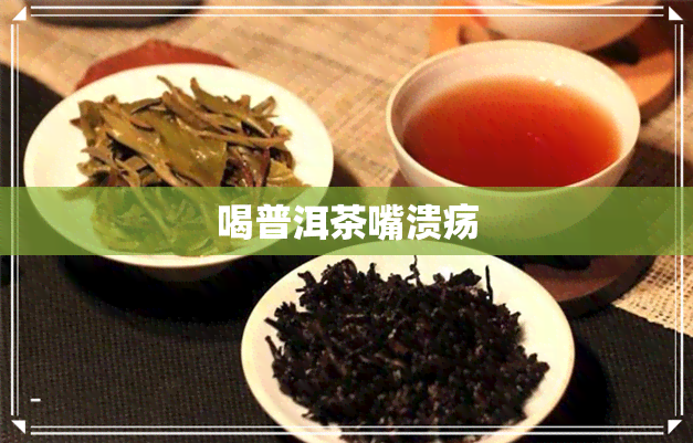 喝普洱茶嘴溃疡