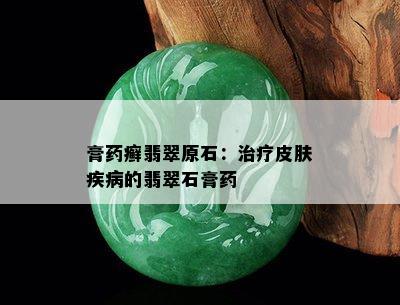 膏药癣翡翠原石：治疗皮肤疾病的翡翠石膏药