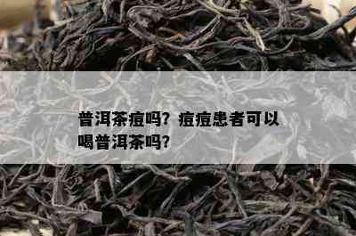 普洱茶痘吗？痘痘患者可以喝普洱茶吗？