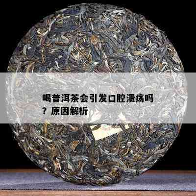 喝普洱茶会引发口腔溃疡吗？起因解析