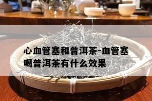 心血管塞和普洱茶-血管塞喝普洱茶有什么效果