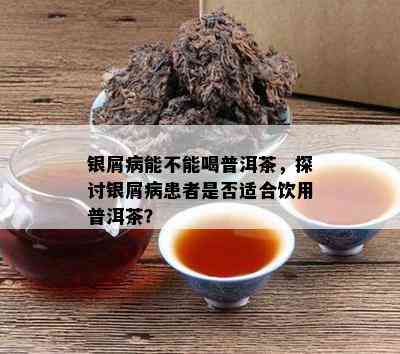 银屑病能不能喝普洱茶，探讨银屑病患者是否适合饮用普洱茶？