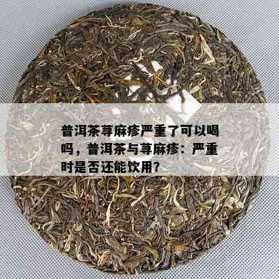 普洱茶荨麻疹严重了可以喝吗，普洱茶与荨麻疹：严重时是不是还能饮用？