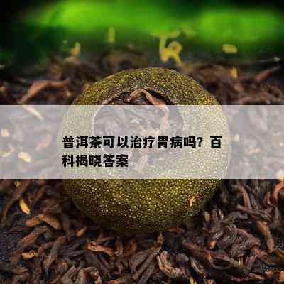 普洱茶可以治疗胃病吗？百科揭晓答案