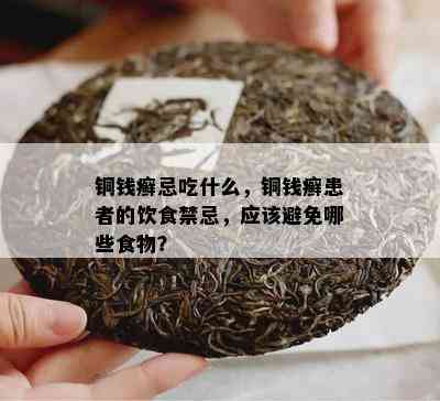 铜钱癣忌吃什么，铜钱癣患者的饮食禁忌，应避免哪些食物？