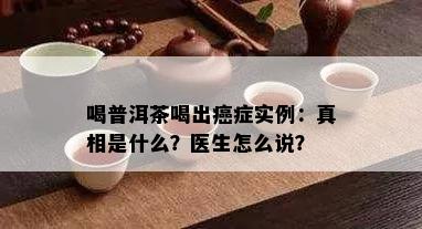 喝普洱茶喝出癌症实例：真相是什么？医生怎么说？