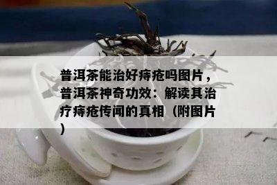 普洱茶能治好痔疮吗图片，普洱茶神奇功效：解读其治疗痔疮传闻的真相（附图片）