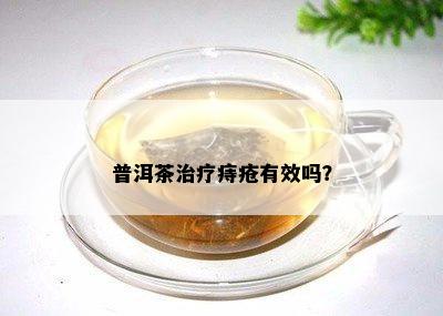 普洱茶治疗痔疮有效吗？