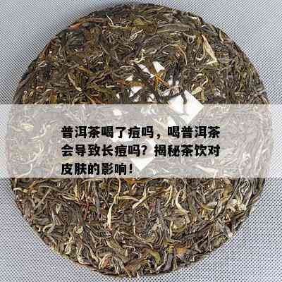 普洱茶喝了痘吗，喝普洱茶会导致长痘吗？揭秘茶饮对皮肤的影响！