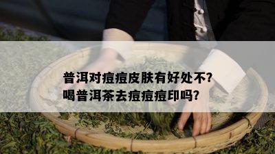 普洱对痘痘皮肤有好处不？喝普洱茶去痘痘痘印吗？