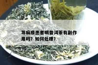 荨麻疹患者喝普洱茶有副作用吗？如何处理？