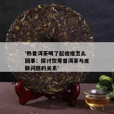 '熟普洱茶喝了起痘痘怎么回事：探讨饮用普洱茶与皮肤问题的关系'