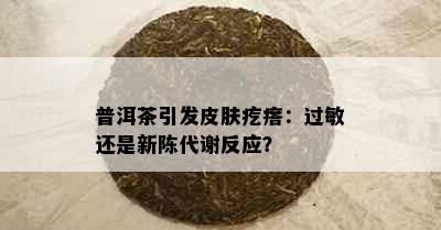 普洱茶引发皮肤疙瘩：过敏还是新陈代谢反应？